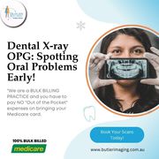 Dental X-ray (OPG): Spotting Oral Problems Early at Butler Medical Ima