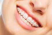 Advanced Smile Alignment Solutions with Orthodontics in Fairfield for 