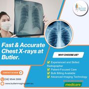 Fast & Accurate Chest X-Rays at Butler Medical Imaging. (08) 9544 3999