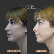 Explore a Consultation-Led Approach to Nasal Profiling