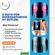 X-rays for Osteoarthritis at Butler Medical Imaging. (08) 9544 3999